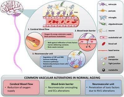 Regional contribution of vascular dysfunction in white matter dementia: clinical and neuropathological insights